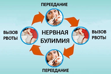 Лечение булимии в Белебее